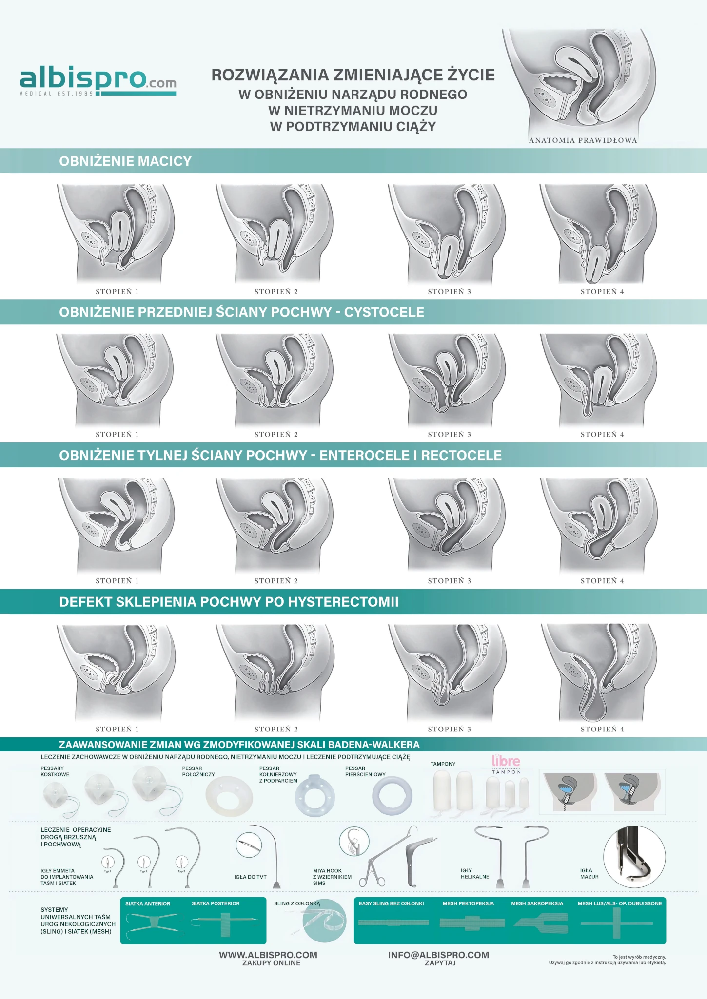 Schemat opuszczenia narządu rodnego