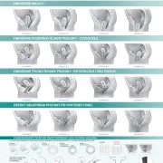 Obniżenie narządu rodnego - problem, który wymaga zrozumienia Obniżenie narządu rodnego - problem, który wymaga zrozumienia