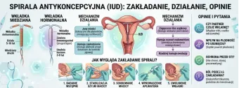 Spirala antykoncepcyjna - zakładanie, działanie, opinie