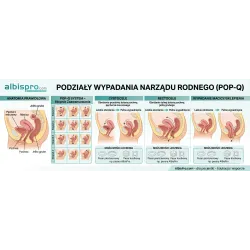 Wypadania narządu rodnego, podział na stopnie w zależności od zaawansowania - prosty przewodnik dla kobiet