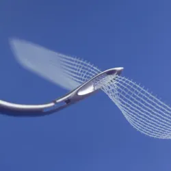 ALBIS Mesh siatka do sakropeksji w kształcie T v3.0