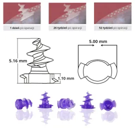 Tacker laparoskopowy 36cm narzędzie do fiksacji 15szt. wchłanialnych kołków 5mm