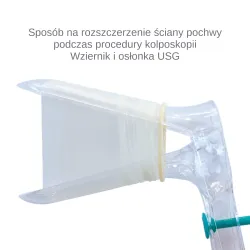 Osłonki pudrowane do głowic endowaginalnych pakowane pojedyńczo 150 szt.