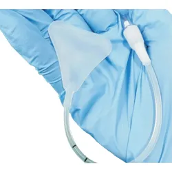 Stent maciczny trójkątny 5ml balon przeciwkrwotoczny tamponada po histeroskopii
